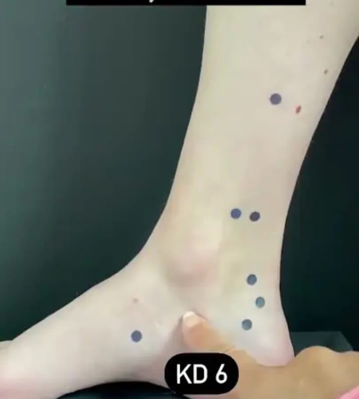 Pressure points marked on the ankle