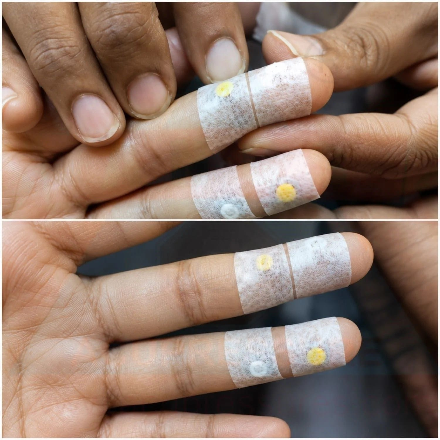 Paper tape used with therapy points